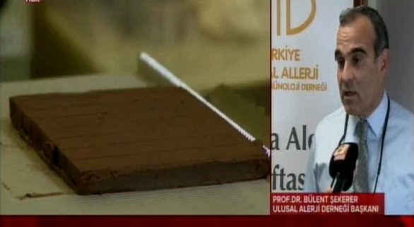 bulent sekerel besin alerjisi açıklaması
