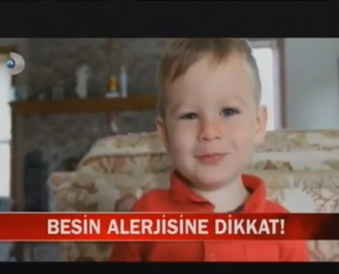 çocuklarda besin alerjisi
