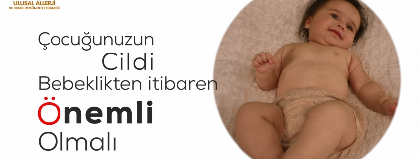 atopik dermatit tedavisi